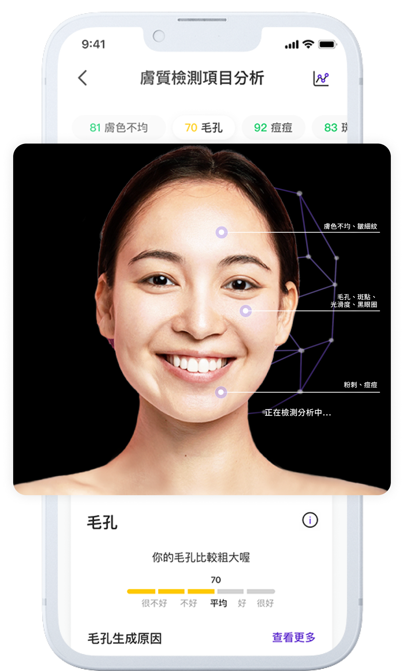 AI Skin Analysis Categories